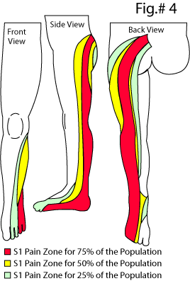 S Dermatome Map